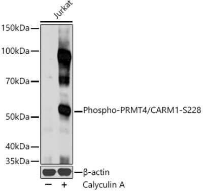 Western Blot: Carm1 [p Ser228] Antibody [NBP3-16892] - Western blot analysis of extracts of Jurkat cells, using Carm1 antibody (NBP3-16892) at 1:1000 dilution.Jurkat cells were treated by Calyculin A (100 nM) at 37C for 30 minutes. Secondary antibody: HRP Goat Anti-Rabbit IgG (H+L) at 1:10000 dilution. Lysates/proteins: 25ug per lane. Blocking buffer: 3% nonfat dry milk in TBST. Detection: ECL Basic Kit. Exposure time: 10s.